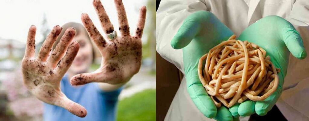 ปรสิตสามารถเข้าสู่ร่างกายผ่านทางมือที่สกปรก