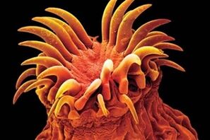 ปรสิต Trematode ในมนุษย์