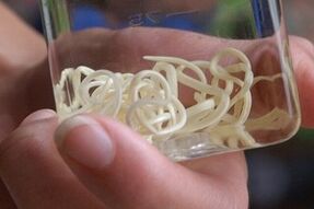 ปรสิตออกจากร่างกายมนุษย์