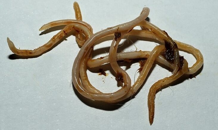 ท็อกโซคาราจากร่างกายมนุษย์